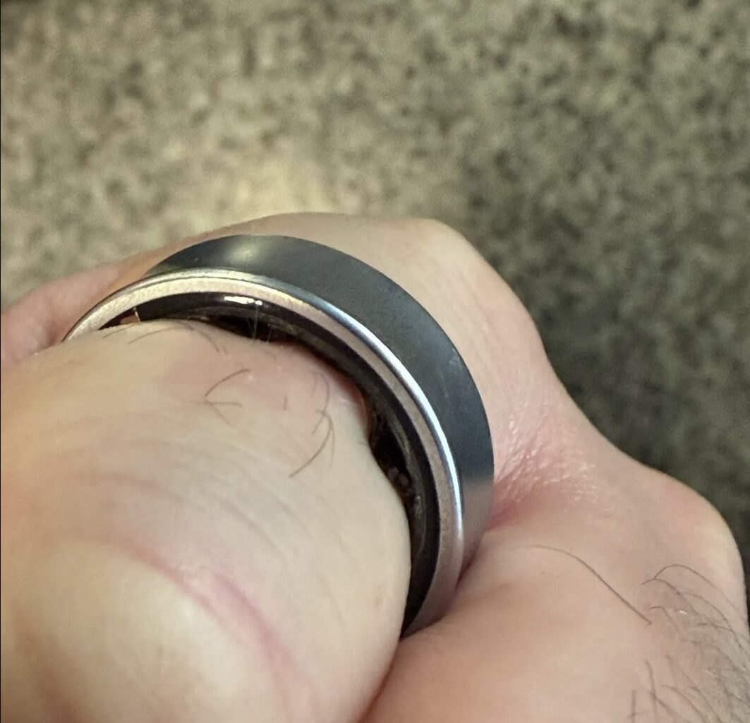 O baterie umflată de Galaxy Ring l-a forțat pe utilizator să apeleze la medici ca să scape de el