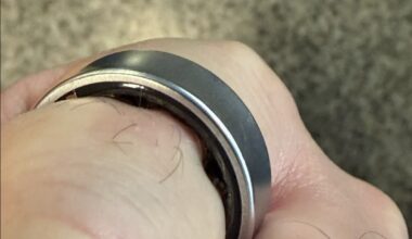 O baterie umflată de Galaxy Ring l-a forțat pe utilizator să apeleze la medici ca să scape de el