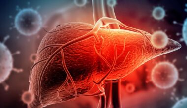 Alertă în Dolj: DSP confirmă 7 focare de hepatită A. Medicii au depistat aproximativ 150 de cazuri