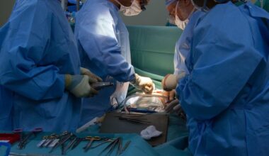 un măcelar, a eliminat părți greșite ale corpului