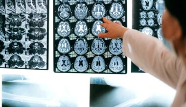 creierul se maturizează mult mai târziu decât corpul