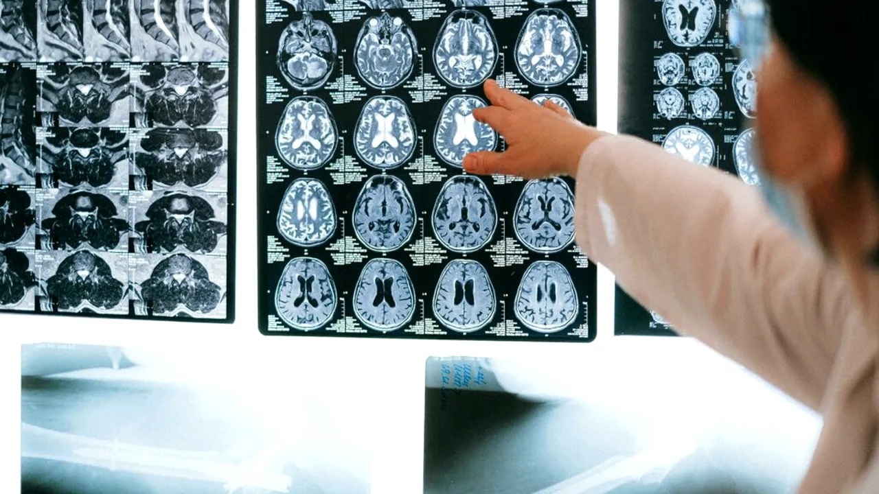 creierul se maturizează mult mai târziu decât corpul