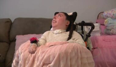 O tânără născută fără creier a împlinit 20 de ani. Medicii nu-și pot explica cum trăiește VIDEO