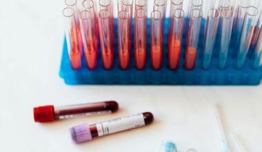 Un test de sânge ar putea detecta boala cu 10 ani înainte de apariţia simptomelor