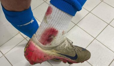 „Ne așteptam să tragă arbitrul cu ei” » Imagine cruntă din vestiar