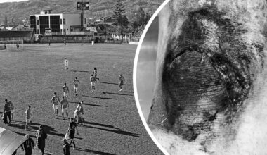 Accidentare de coșmar în Liga 2 din România! Fotbalistul crescut de Hagi și-a făcut franjuri genunchiul: „Am căzut într-o buză de canal din fier!” » Reacția clubului: „Ce canal? Era nisip”