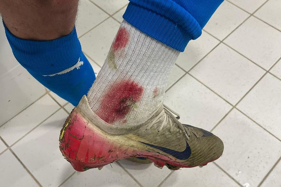 Oltenii acuză: „Ne așteptam să tragă arbitrul cu ei” » Imagine cruntă din vestiar