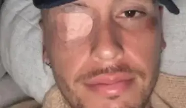 I-a paralizat fața: „Problemă de natură virală”