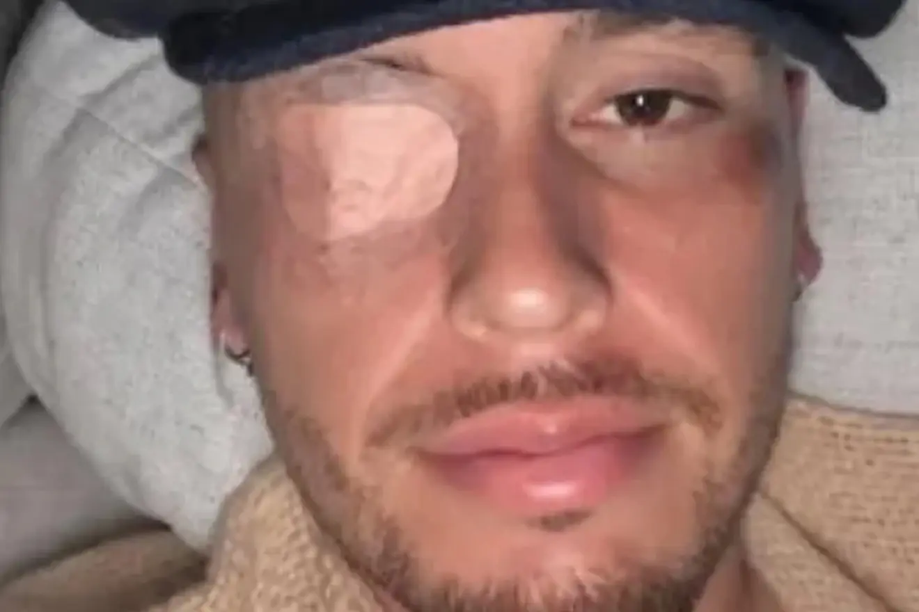 I-a paralizat fața: „Problemă de natură virală”