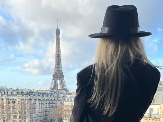 ”A trebuit să-mi acopăr zonele cu chelie”