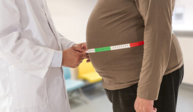 Tratamentele moderne pentru slăbit nu vor rezolva problema obezităţii la nivel mondial