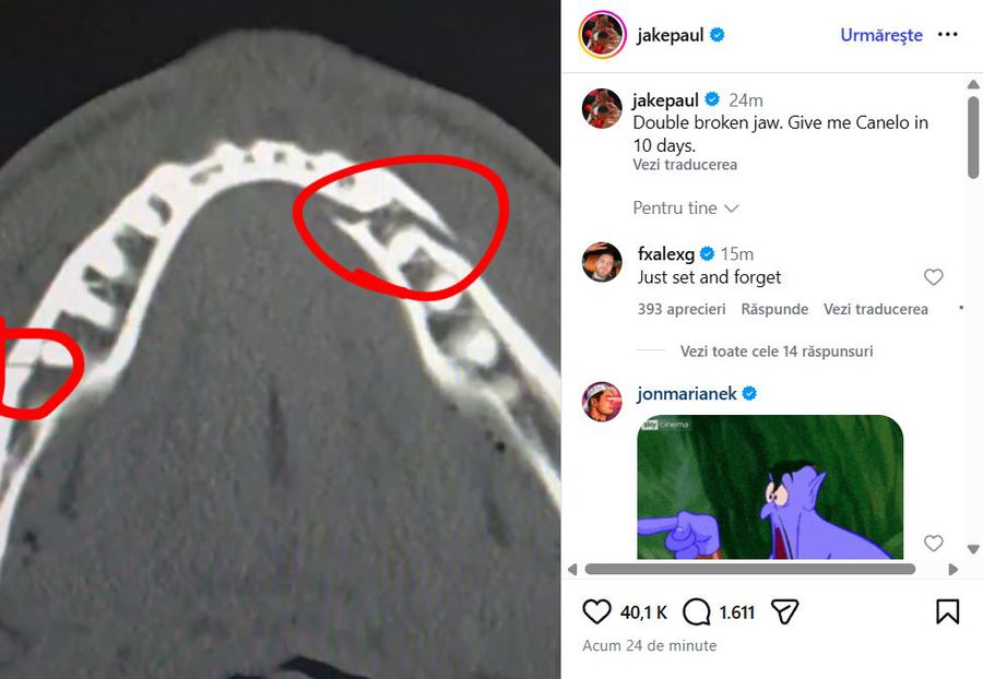 KO în runda 6! Anthony Joshua i-a făcut o fractură dublă de mandibulă lui Jake Paul, în lupta de 200 de milioane $