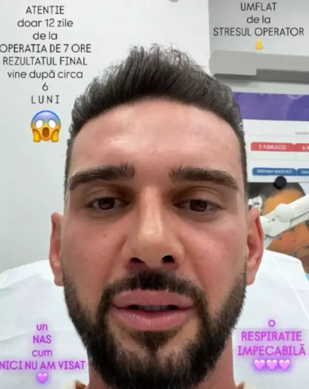 dorian popa dupa operatia la nas