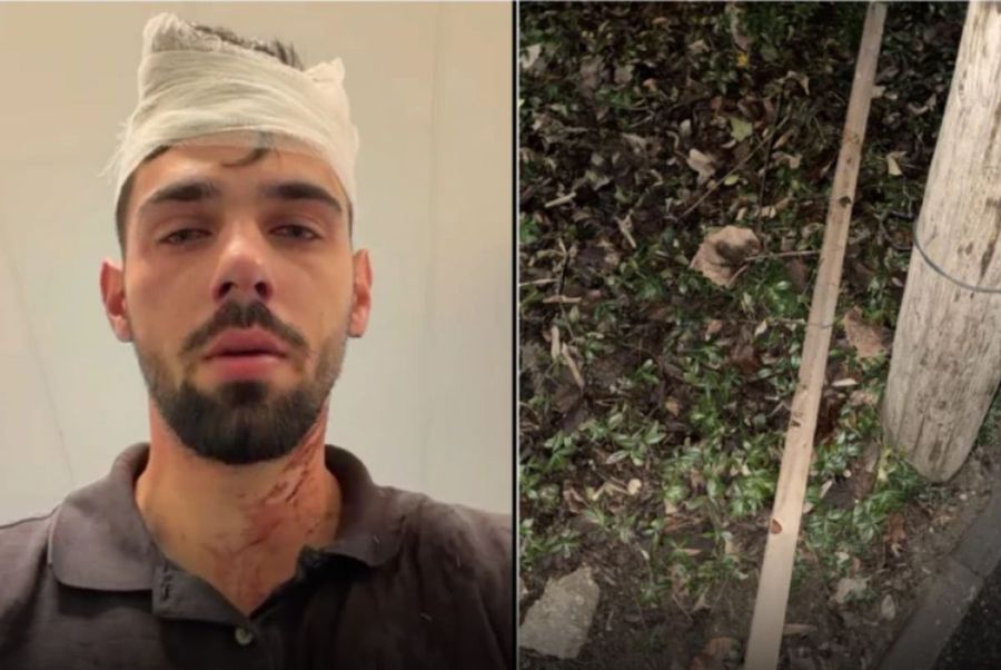 Șocant scandal! Doi fotbaliști de la Poli Timișoara, acuzați că au snopit în bătaie un tânăr de 19 ani: „Huliganii mi-au nenorocit copilul! Parul cu care l-au lovit e plin de sângele lui”