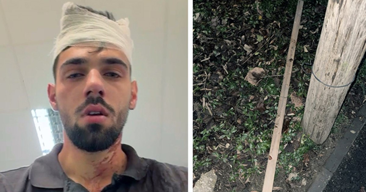 Mai mulți fotbaliști de la Poli Timișoara, acuzați că au bătut cu bestialitate un adolescent de 19 ani. „Dacă avea cu câteva kilograme mai puţin, îi măturam creierii de pe asfalt”