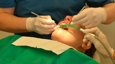 Doi stomatologi au fost condamnați la închisoare după ce i-au scos unei femei 11 dinți sănătoși. „Aveam un iubit și l-am părăsit pentru că mi-era rușine”