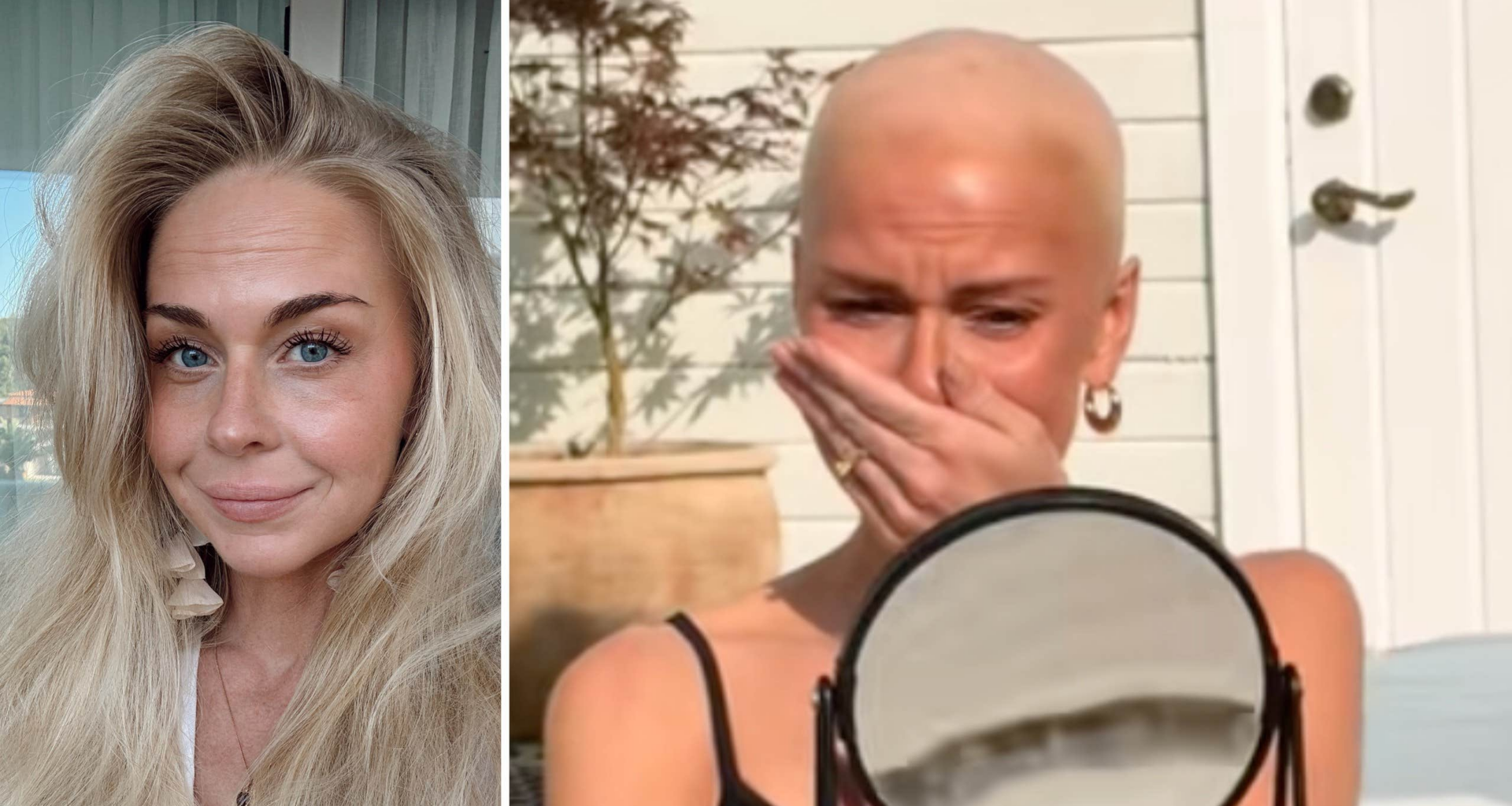 Tvingas raka av allt hår
