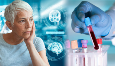 Enkelt blodprov avslöjar:
Då har du alzheimer