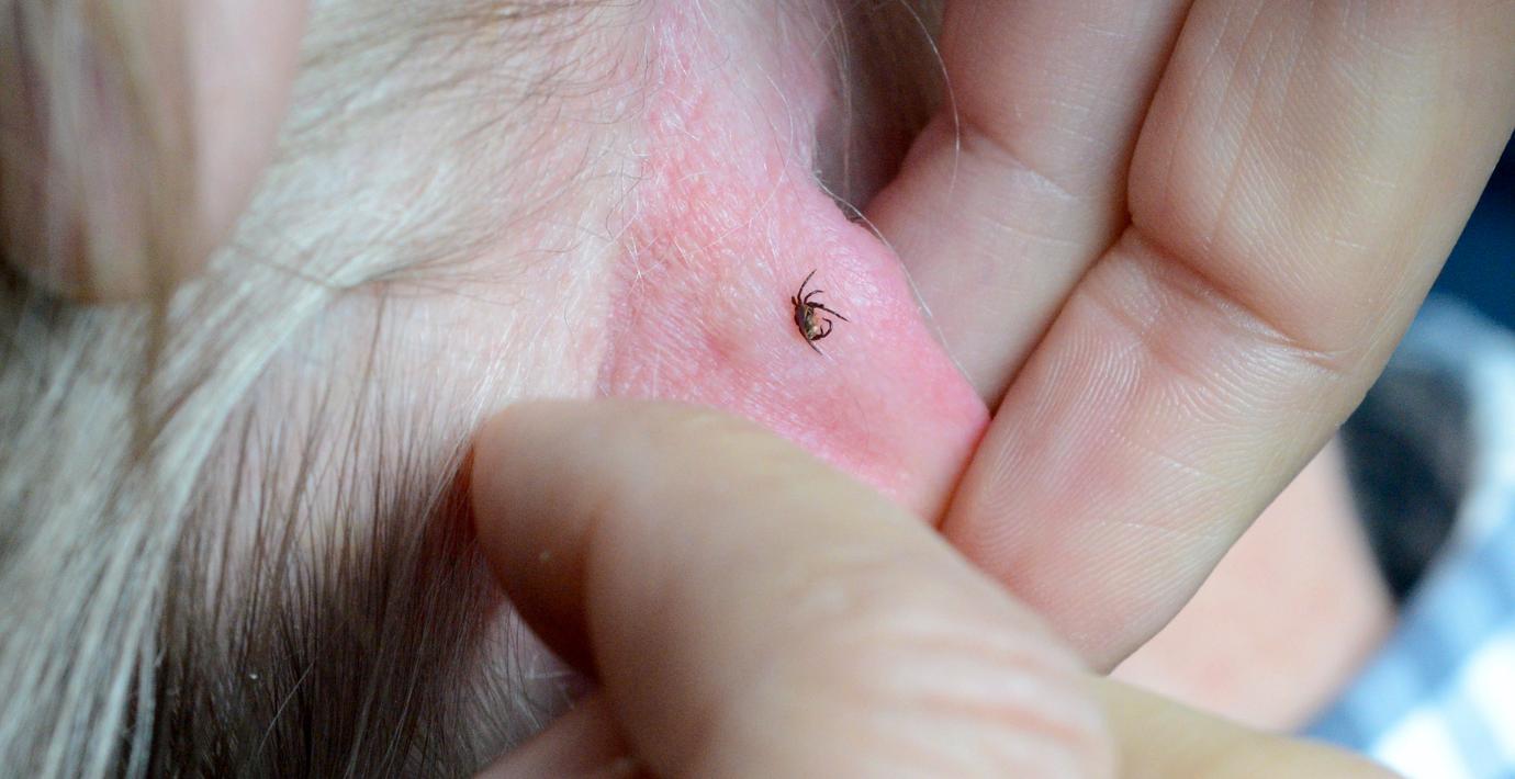 Sjukaste smärtan – ville ut ur kroppen