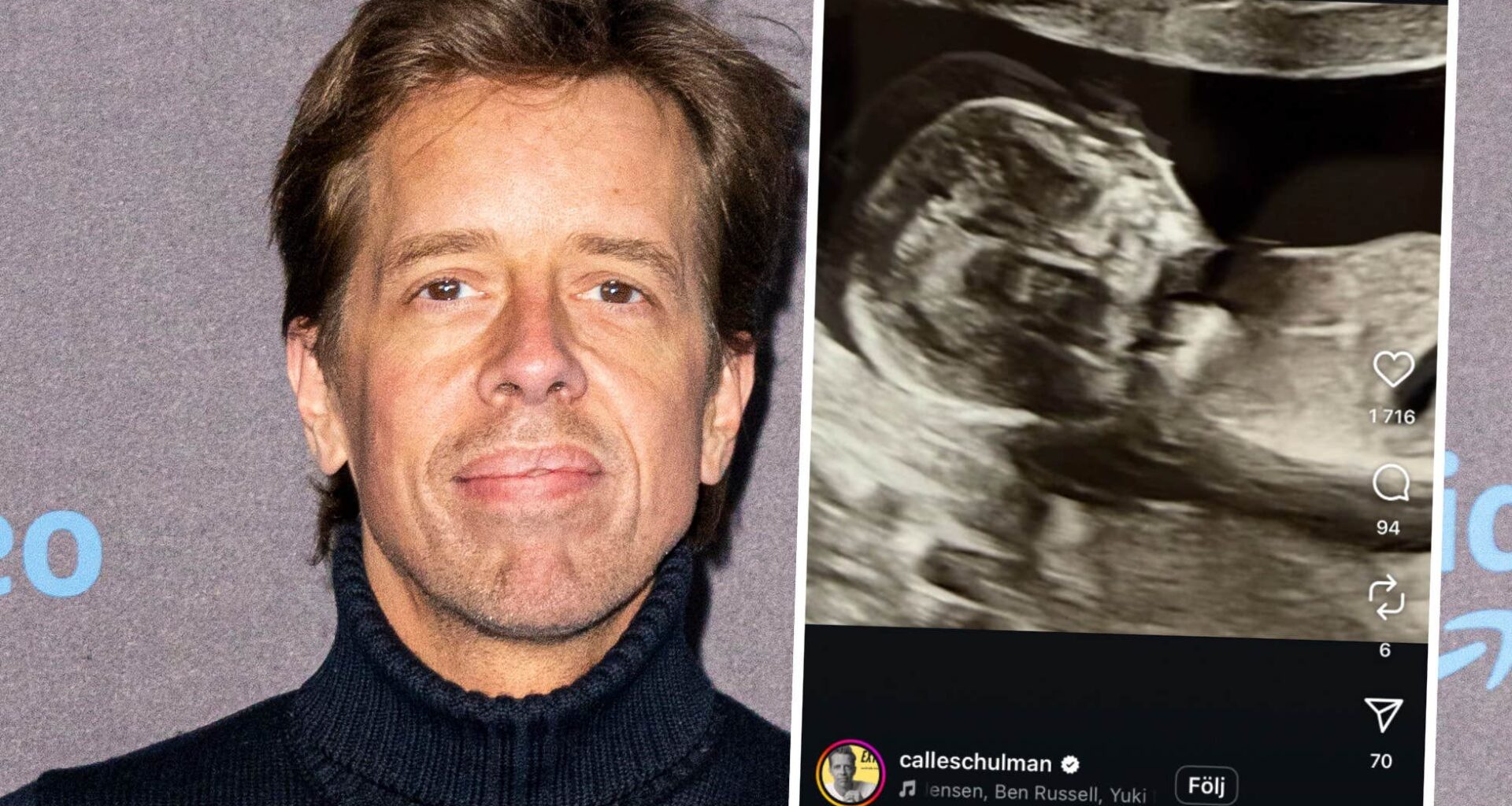 Calle Schulman blir pappa igen
