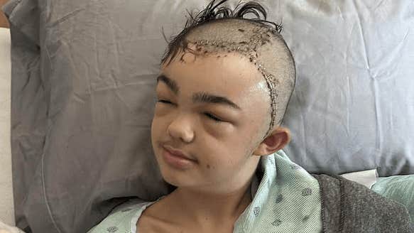 Lukas, 14, drog skämt –
förlorade delar av skallen