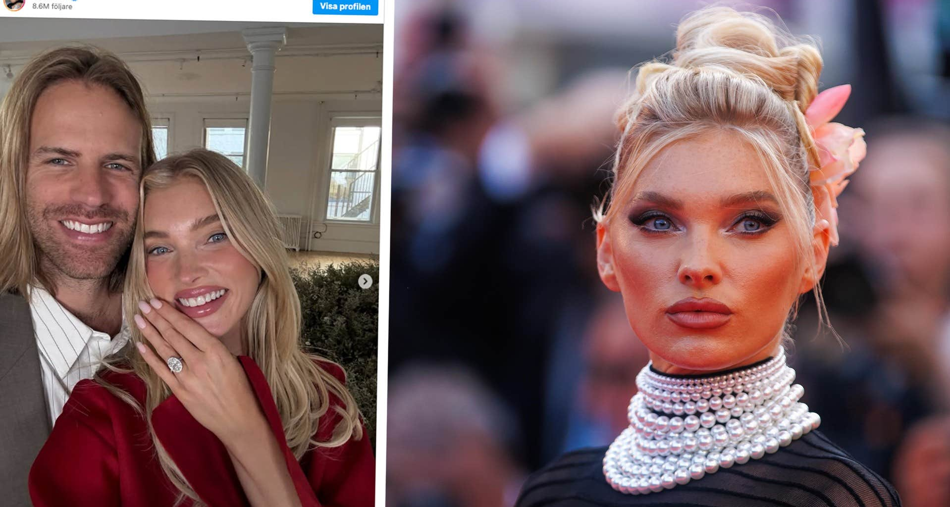 Elsa Hosk har förlovat sig med Tom Daly – visar upp ringen
