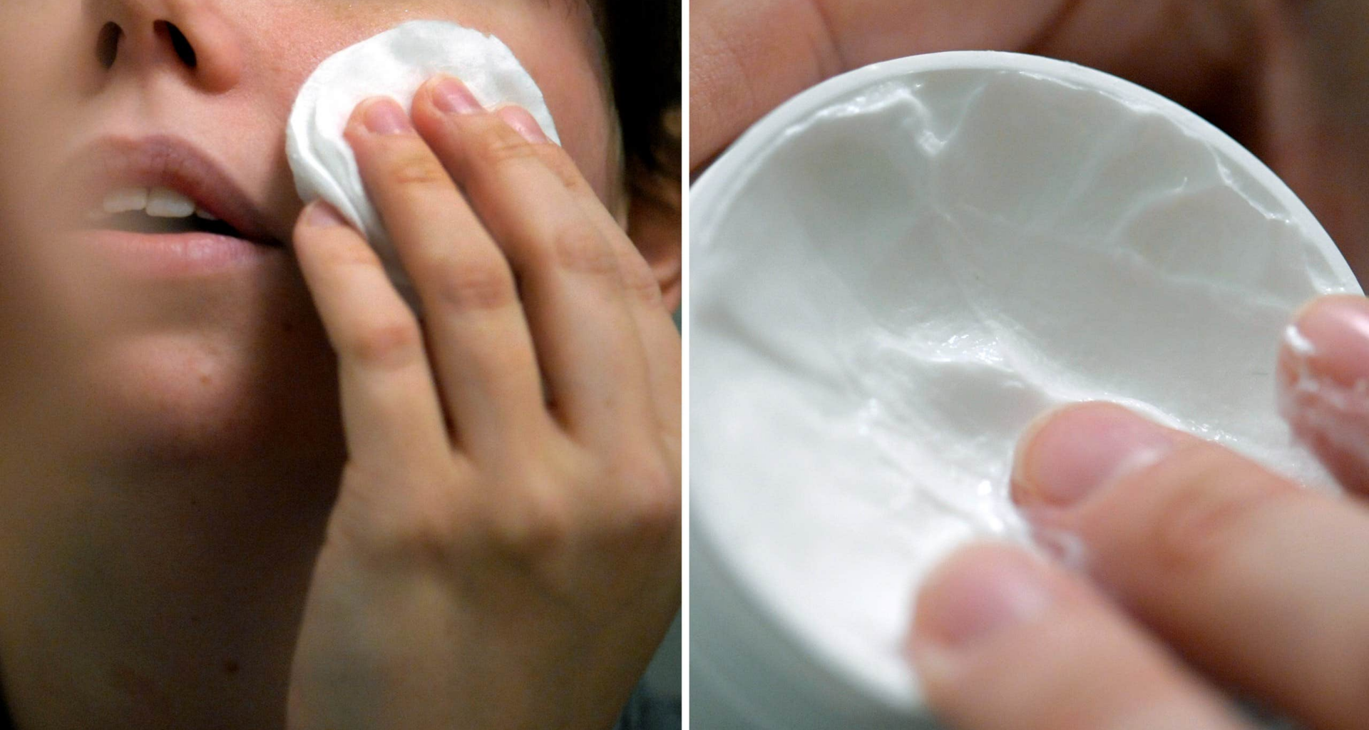 ST-läkarens varning till unga om hudvård: Kan ge problem