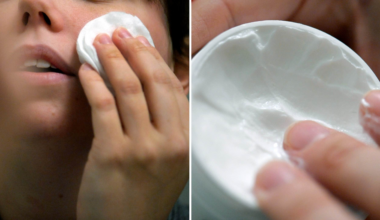 ST-läkarens varning till unga om hudvård: Kan ge problem