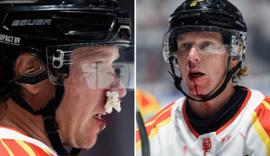 Blodiga bilder på Nicklas Bäckström – sedan vände Malmö matchen | SHL