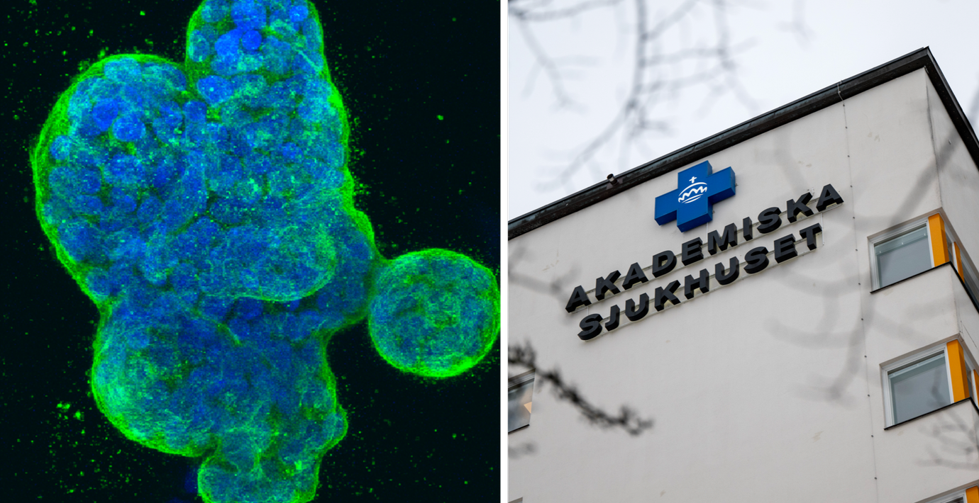 Görans cancer försvann efter ny Uppsalaforskning