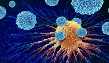 Vita blodkroppar, leukocyter, attackerar en cancercell.