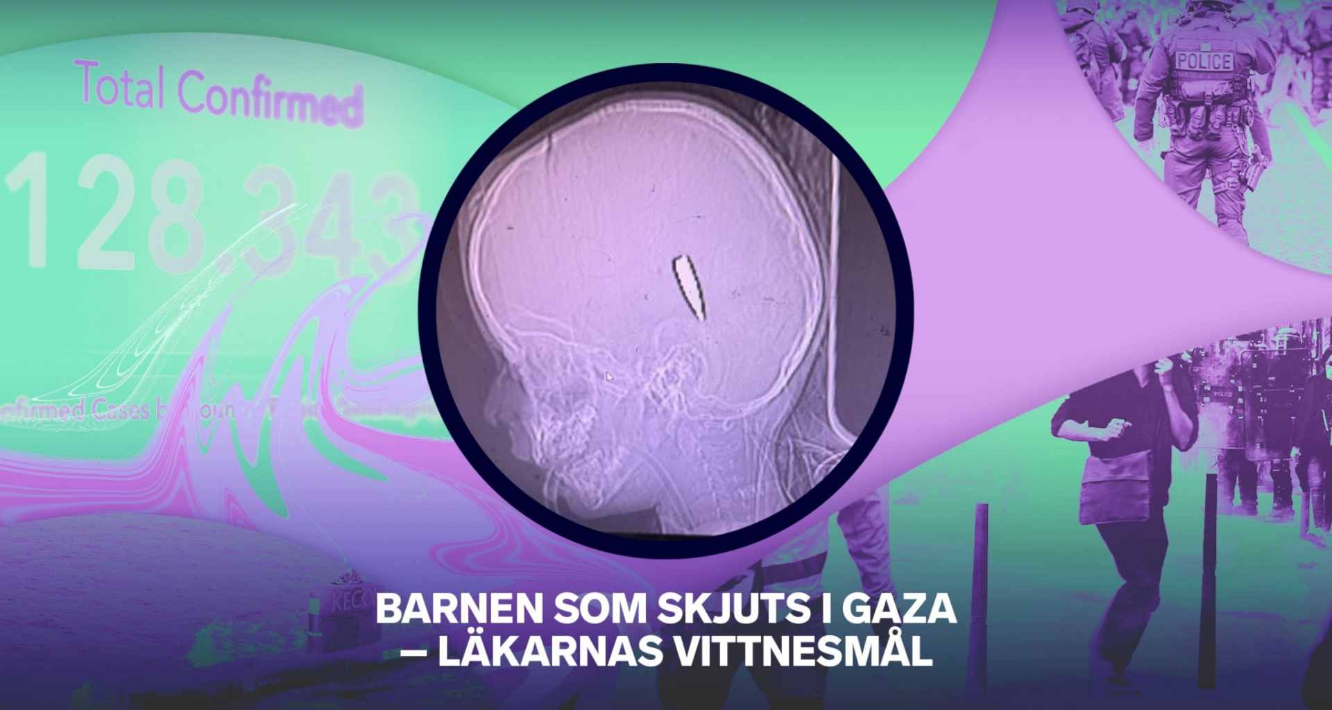 Barnen som skjuts i Gaza – läkarnas vittnesmål – P3 Nyheter Dokumentär 29 september 2025 - P3 Nyheter Dokumentär