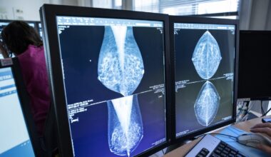 Bröstcancer tar ingen paus när man fyllt 74 – Sundsvalls Tidning