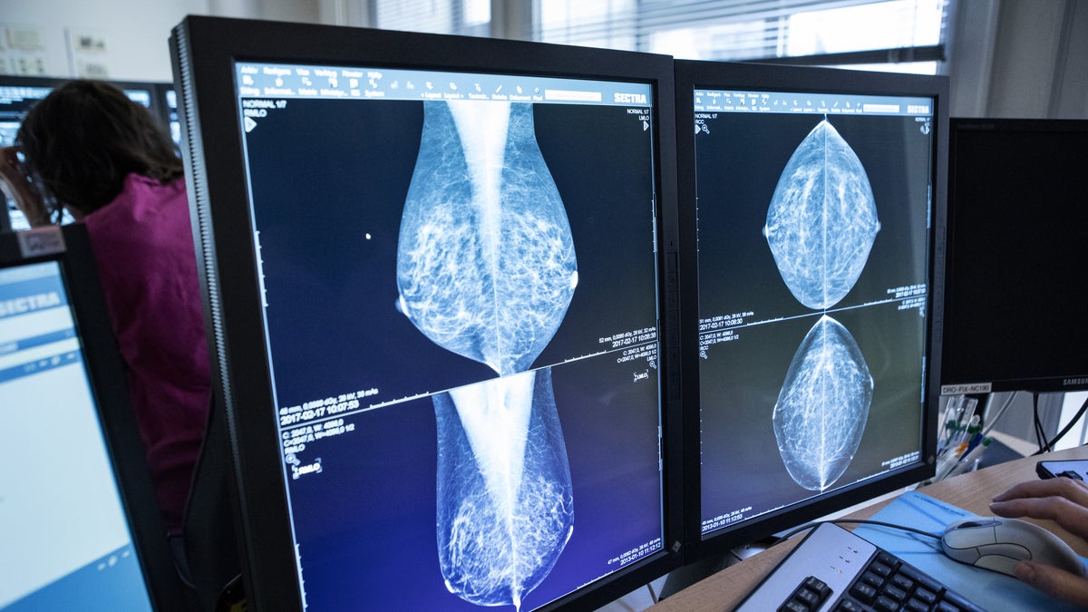 Bröstcancer tar ingen paus när man fyllt 74 – Sundsvalls Tidning