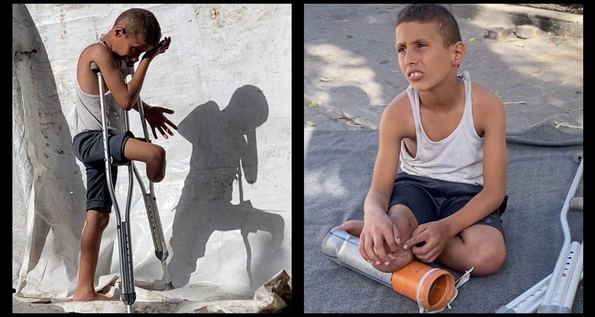 Rateb, 10, gjorde sin egen protes i Gaza – av ett plaströr