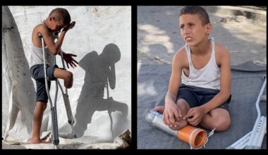 Rateb, 10, gjorde sin egen protes i Gaza – av ett plaströr