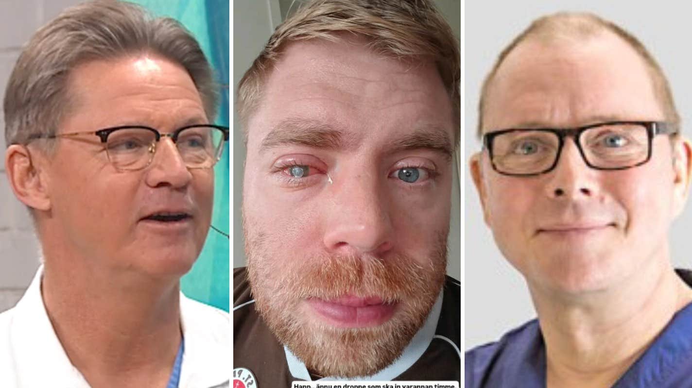 Ögonexpertens ord efter GVFÖ-Dennis skräckbesked om ögat