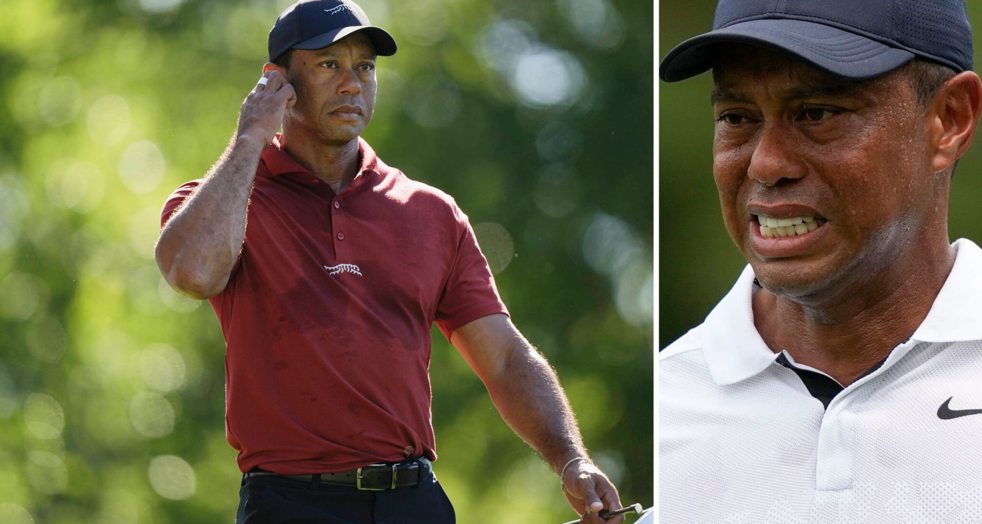 Tiger Woods opererad
 ”Hade kollapsat”