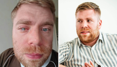 SVT-profilens nya hopp: Unik medicin