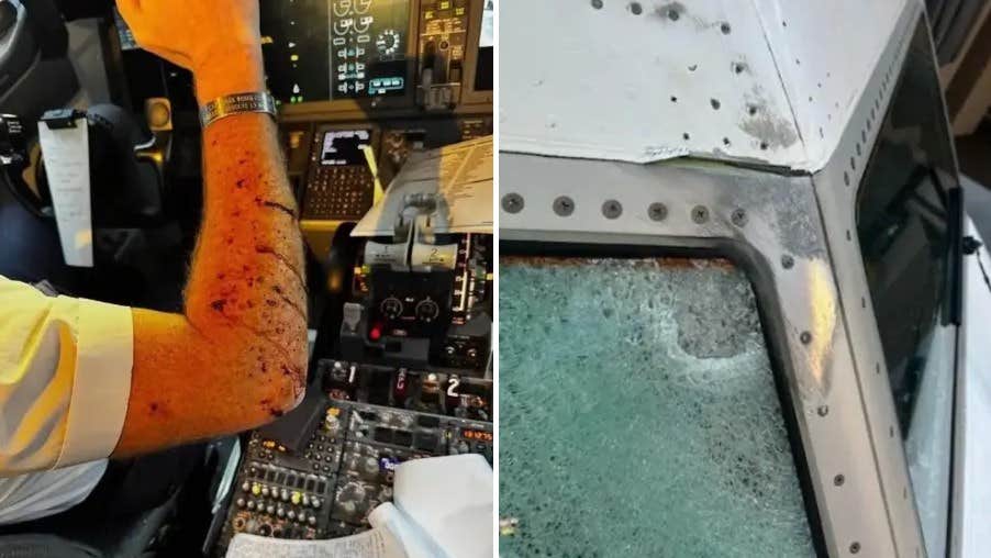 Pilotens mystiska skada
– på 11 000 meters höjd