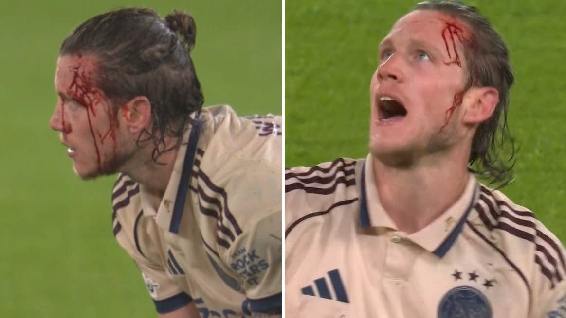 Blodiga bilder på Wout Weghorst – när Chelsea krossade Ajax | Champions League