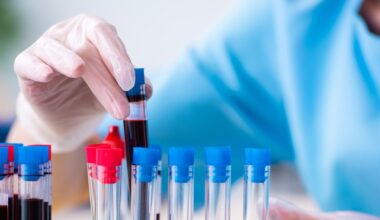 Blodtest visar lovande resultat vid ME – kan leda till ny diagnosmetod