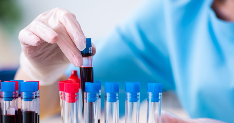 Blodtest visar lovande resultat vid ME – kan leda till ny diagnosmetod