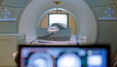 AI kan rädda barn med epilepsi