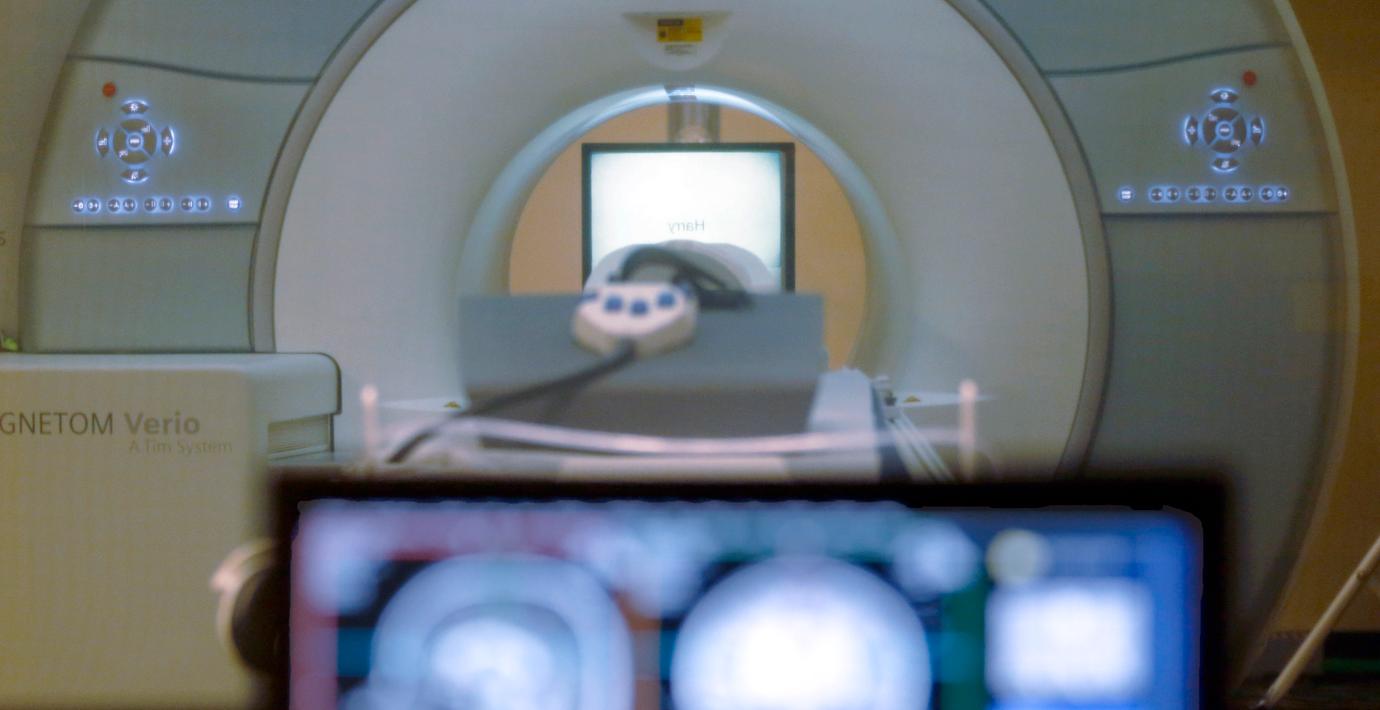 AI kan rädda barn med epilepsi