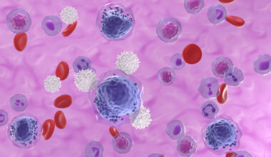 Celler i blodbanan. t-celler omringar stora cancerceller.