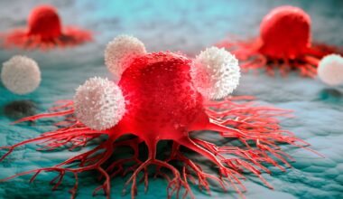 Alzheimerpatienter löper mindre risk för cancer
