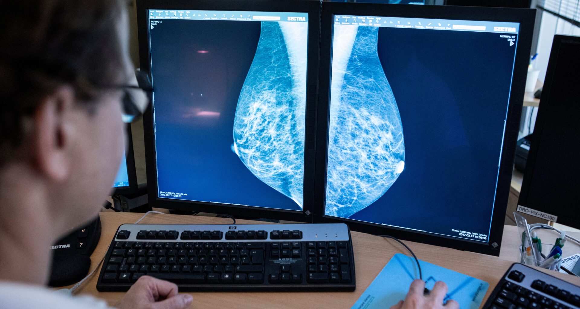 Debatt: Rädda liv med höjd åldersgräns för mammografi - SN, Södermanlands Nyheter