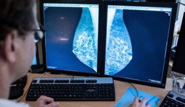 Debatt: Rädda liv med höjd åldersgräns för mammografi - SN, Södermanlands Nyheter