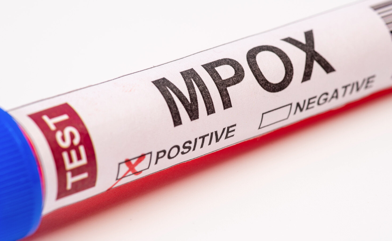 ECDC: Den farligare typen av mpox sprids nu i Europa